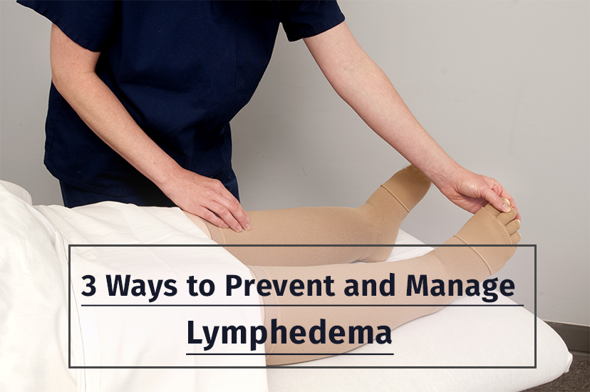 3 Ways to Prevent and Manage Lymphedema