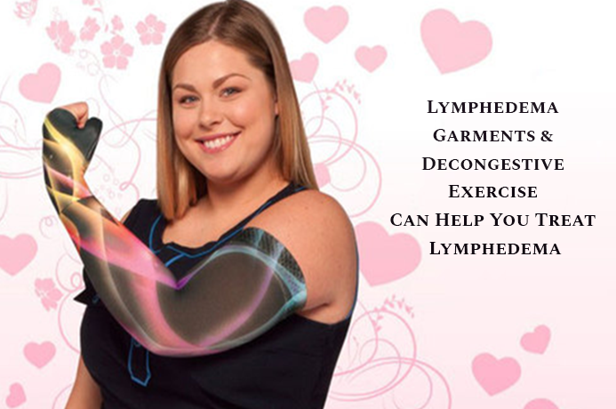 Lymphedema Garments & Decongestive Exercise Can Help You Treat Lymphedema